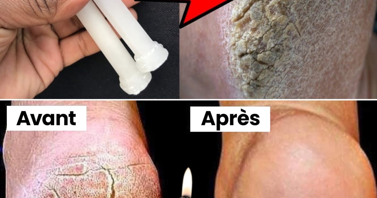 Adoucissez, soignez et restaurez vos pieds pendant la nuit avec de la cire de bougie