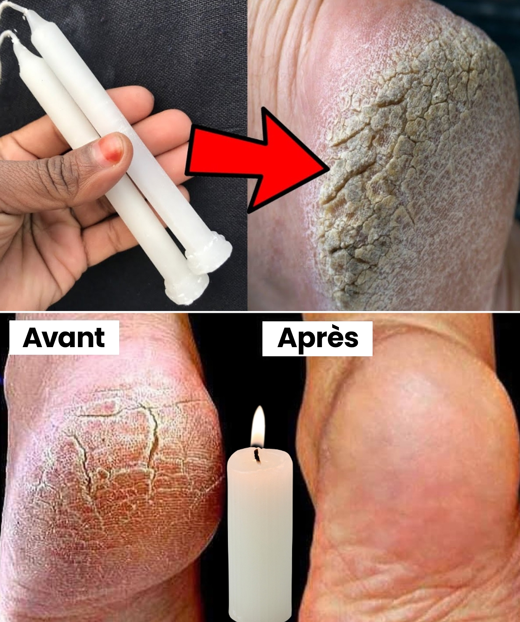 Adoucissez, soignez et restaurez vos pieds pendant la nuit avec de la cire de bougie