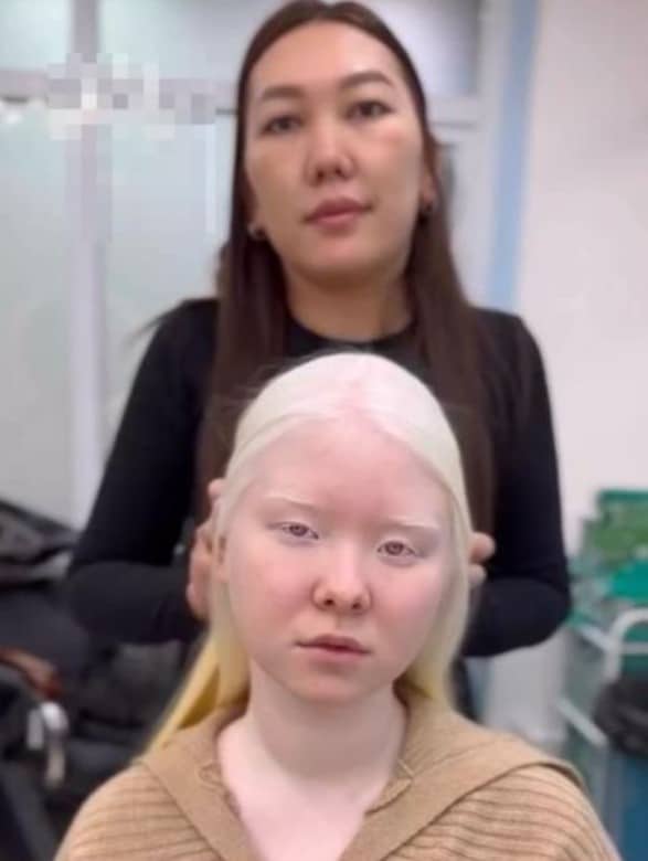 Transformation capillaire d'une personne albinos