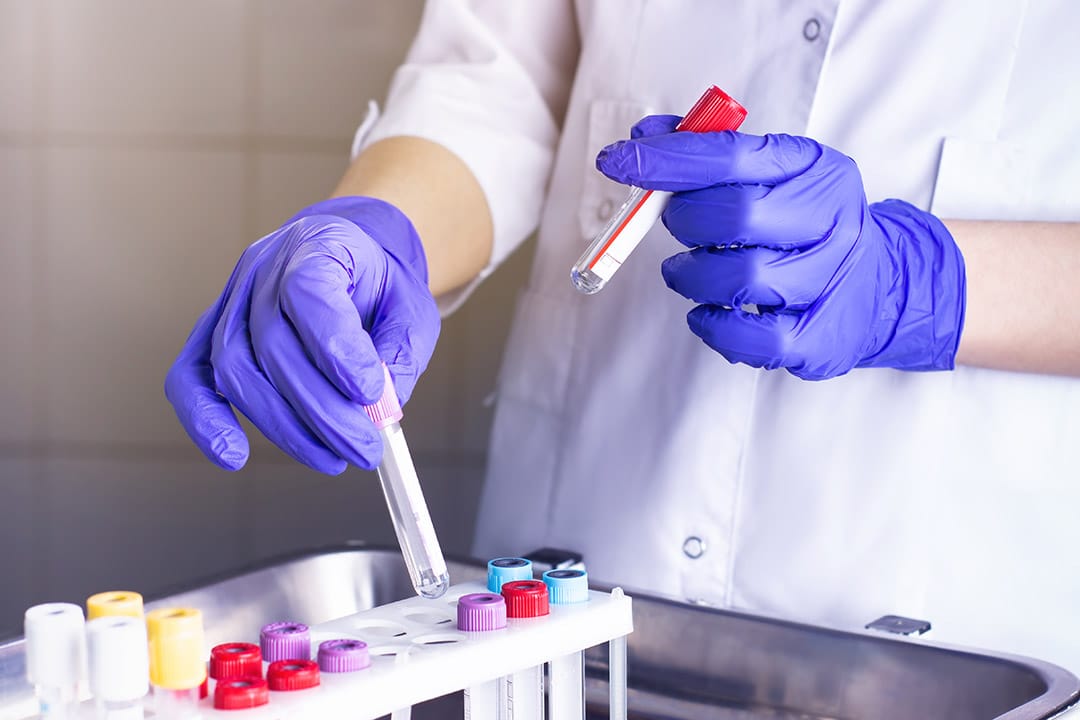 Prise de sang en laboratoire