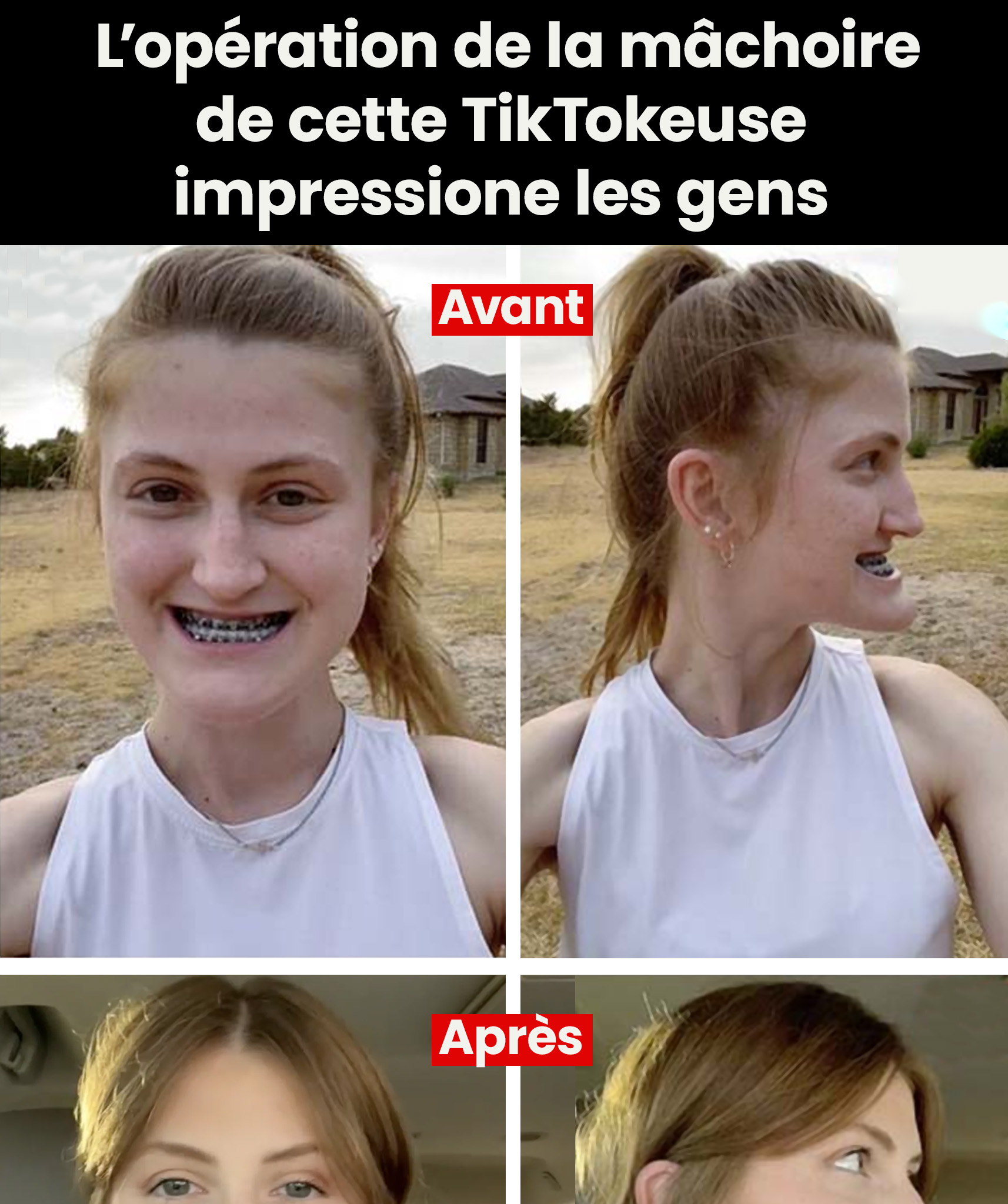 Après son opération de la mâchoire, une TikTokkeuse suscite l’intérêt des internautes