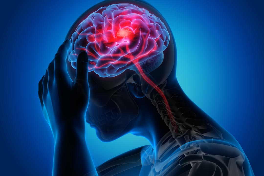 Votre corps vous alerte un mois avant un AVC : ces 10 signaux d’alerte à ne surtout pas négliger