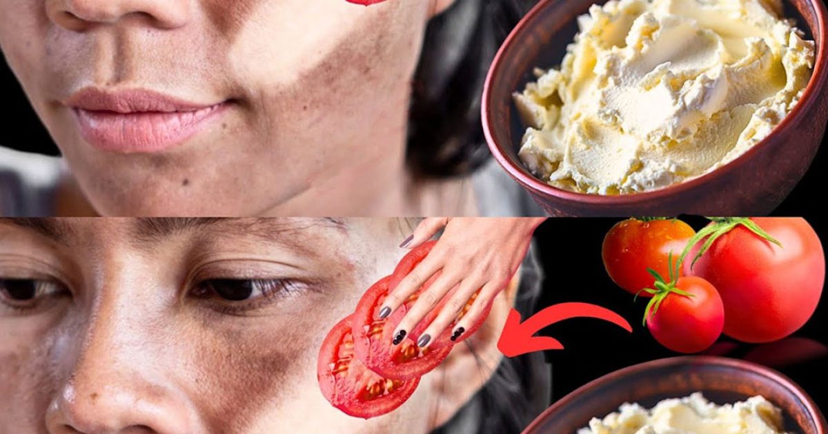 Ayez une apparence fraîche et jeune avec ce simple masque à la tomate et à la fécule de maïs