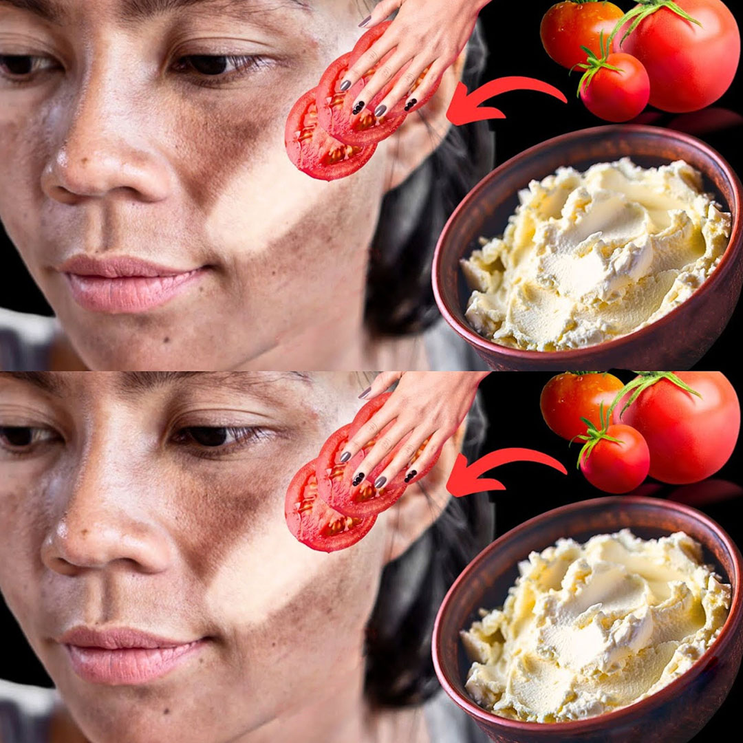 Ayez une apparence fraîche et jeune avec ce simple masque à la tomate et à la fécule de maïs