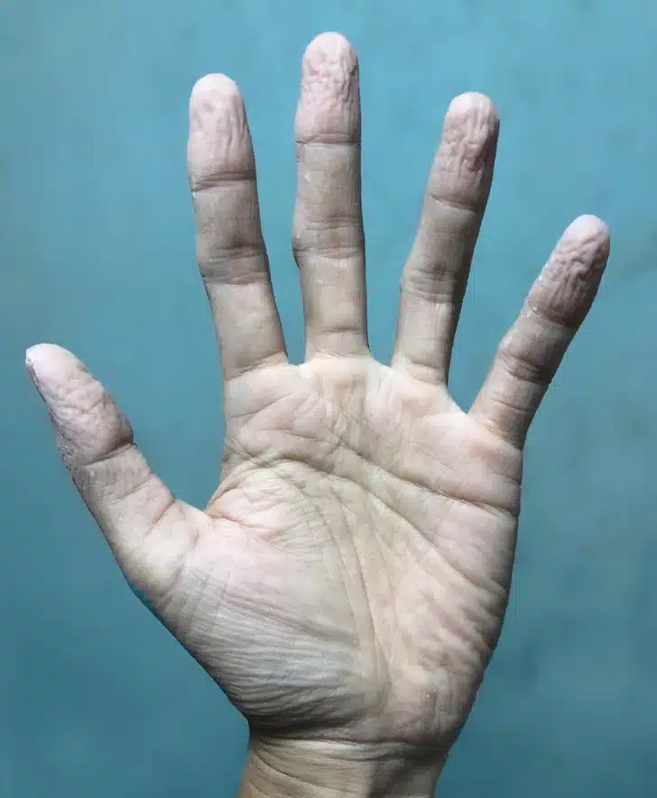 Votre corps tire la sonnette d’alarme : 11 signaux à ne plus ignorer