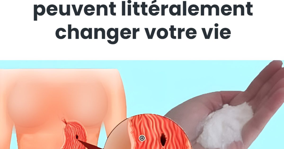 Bicarbonate de soude : un meilleur remède naturel pour soulager les brûlures d’estomac