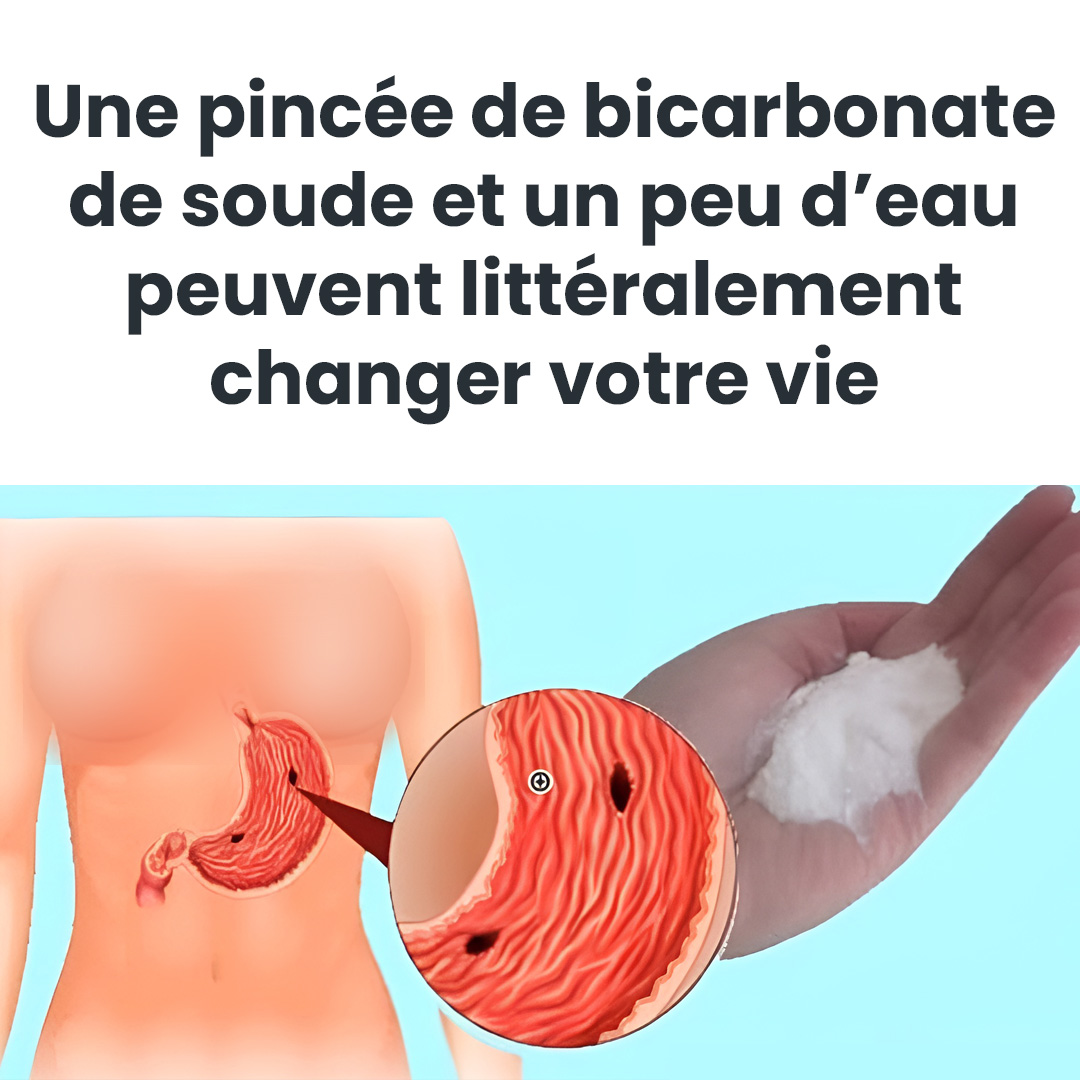 Bicarbonate de soude : un meilleur remède naturel pour soulager les brûlures d’estomac