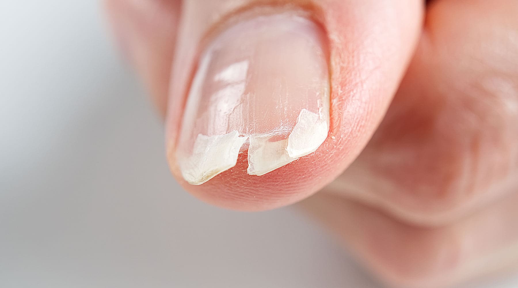 Ongles qui se fendent ou se dédoublent ? Décryptez le signal d'alarme que vous envoie votre organisme