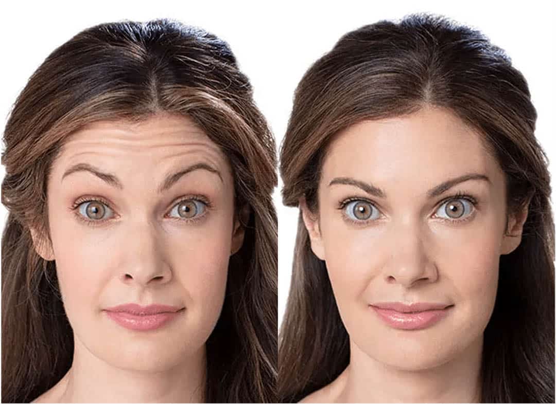 Le duo café-vaseline : le secret d’une peau éclatante sans produits chimiques