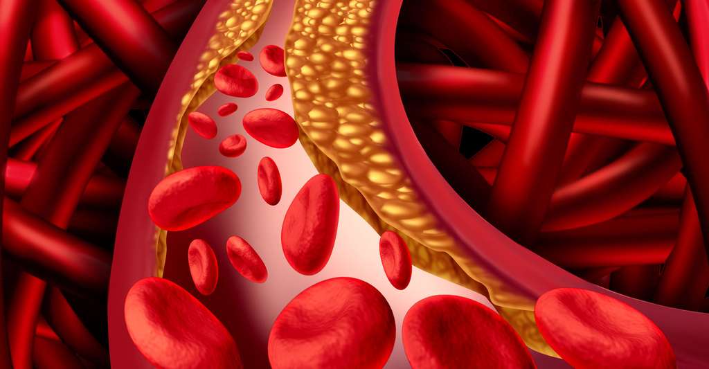 Votre oreiller trempé au réveil ? Ces 6 pathologies pourraient expliquer pourquoi vous bavez la nuit