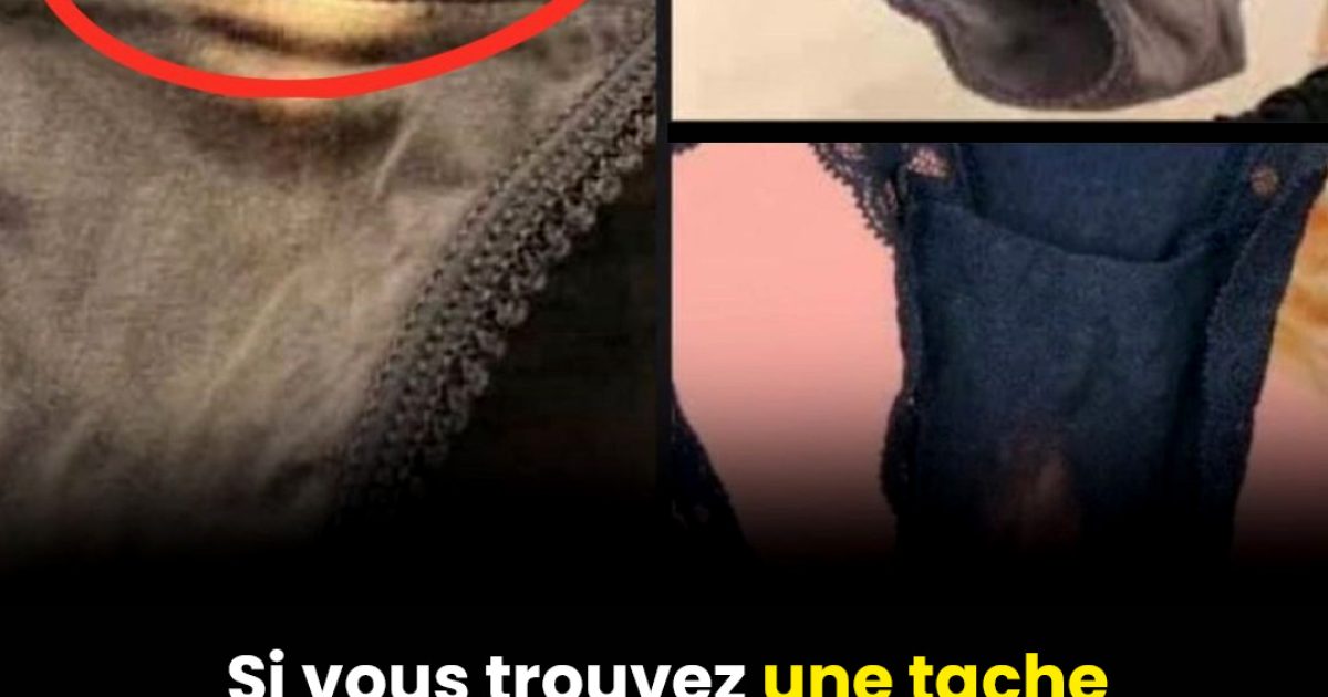 Ce que signifie une tache blanchâtre sur vos sous-vêtements