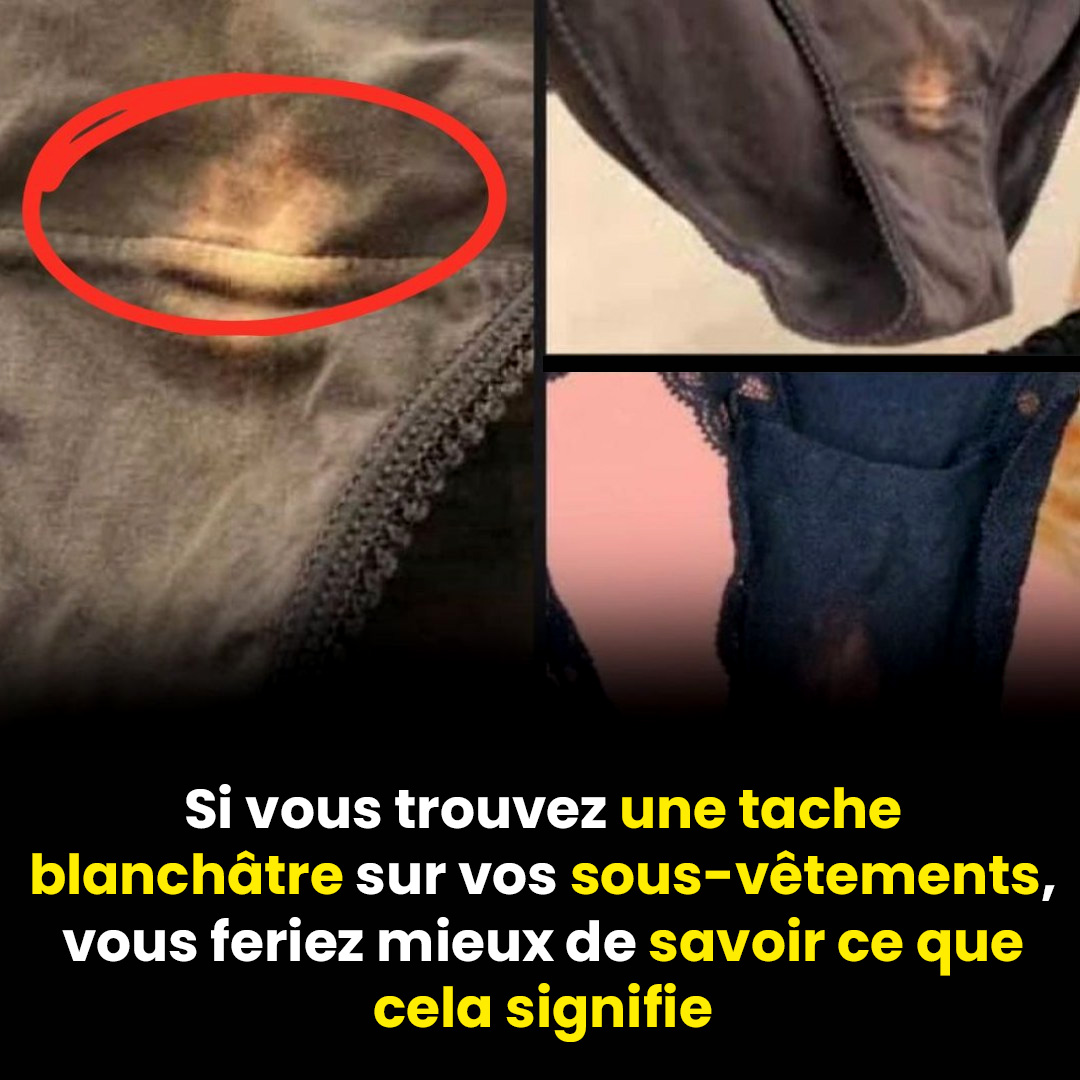 Ce que signifie une tache blanchâtre sur vos sous-vêtements