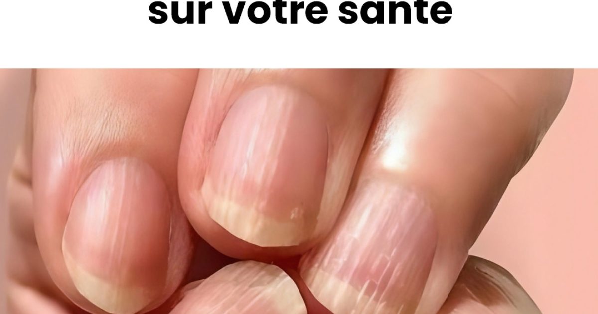 Ce que vos ongles disent de votre santé