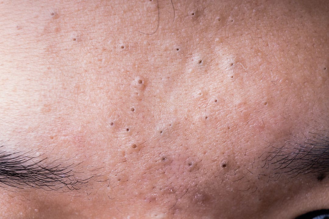 Masque au charbon actif