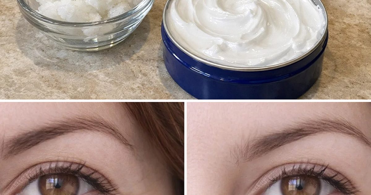 Comment associer l’huile de coco et la crème Nivea pour atténuer les rides et les ridules d’expression ?