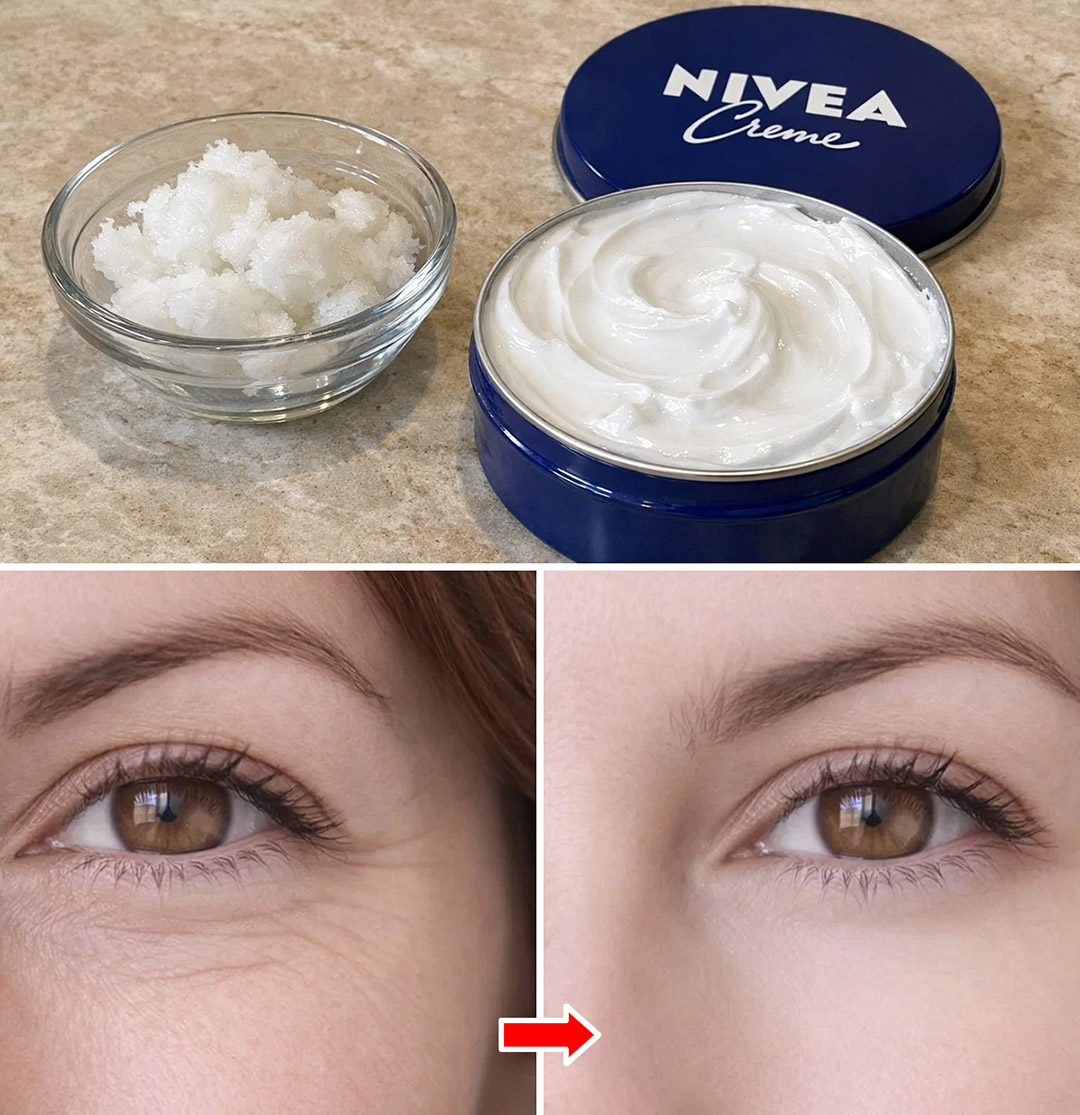 Comment associer l’huile de coco et la crème Nivea pour atténuer les rides et les ridules d’expression ?