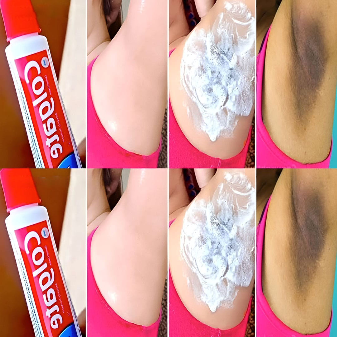 Comment éclaircir naturellement les aisselles à l’aide du dentifrice ?