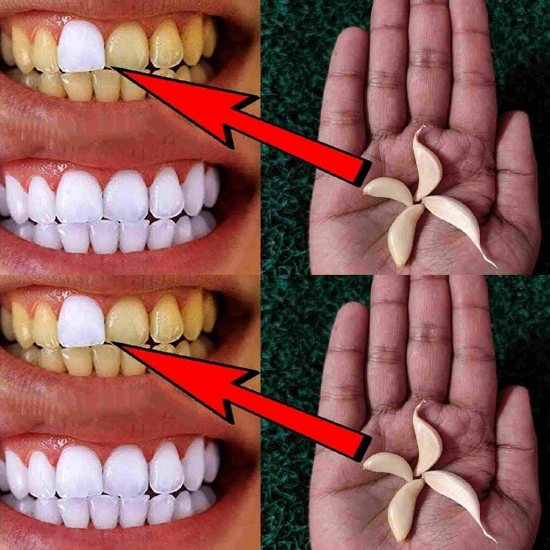 Comment utiliser l’ail pour blanchir les dents ?
