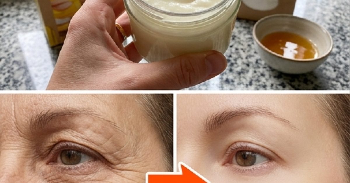 Comment préparer la crème anti-rides à effet botox pour le visage à base de miel et de fécule de maïs