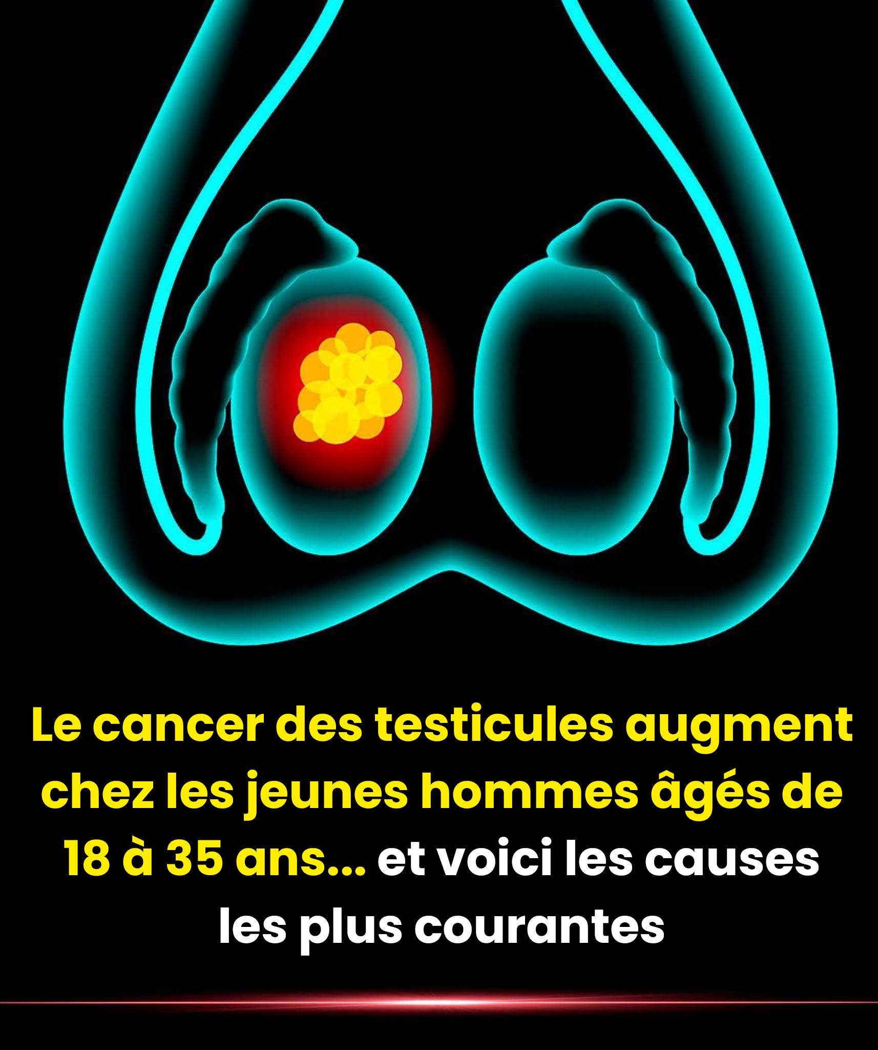 Comment prévenir le cancer des testicules chez les jeunes ?