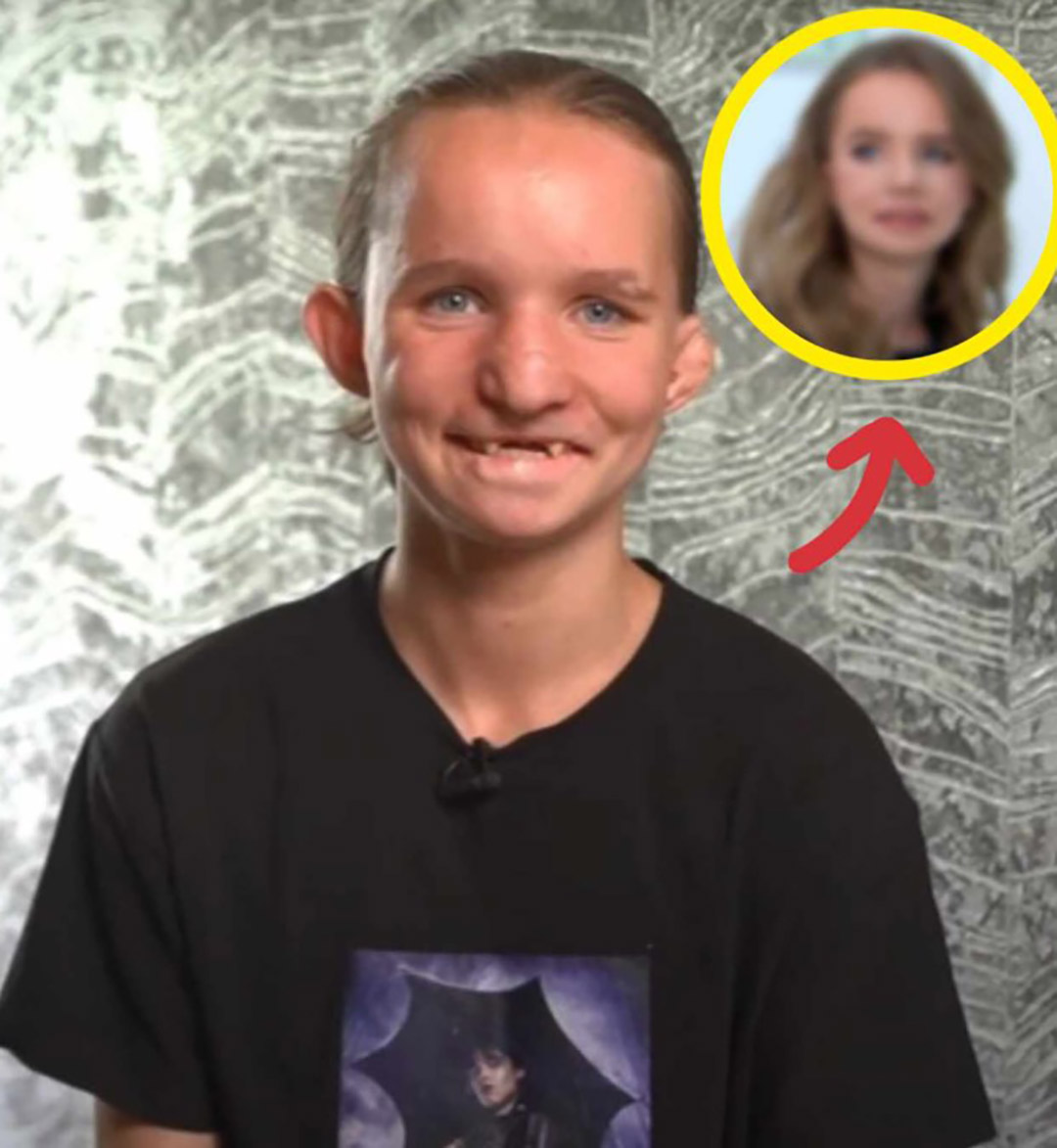 Comment reconnaître une personne après avoir traversé une enfance difficile et vécu une opération qui transforme une vie ? Son parcours montre combien la résilience peut illuminer le changement et révéler une nouvelle force intérieure