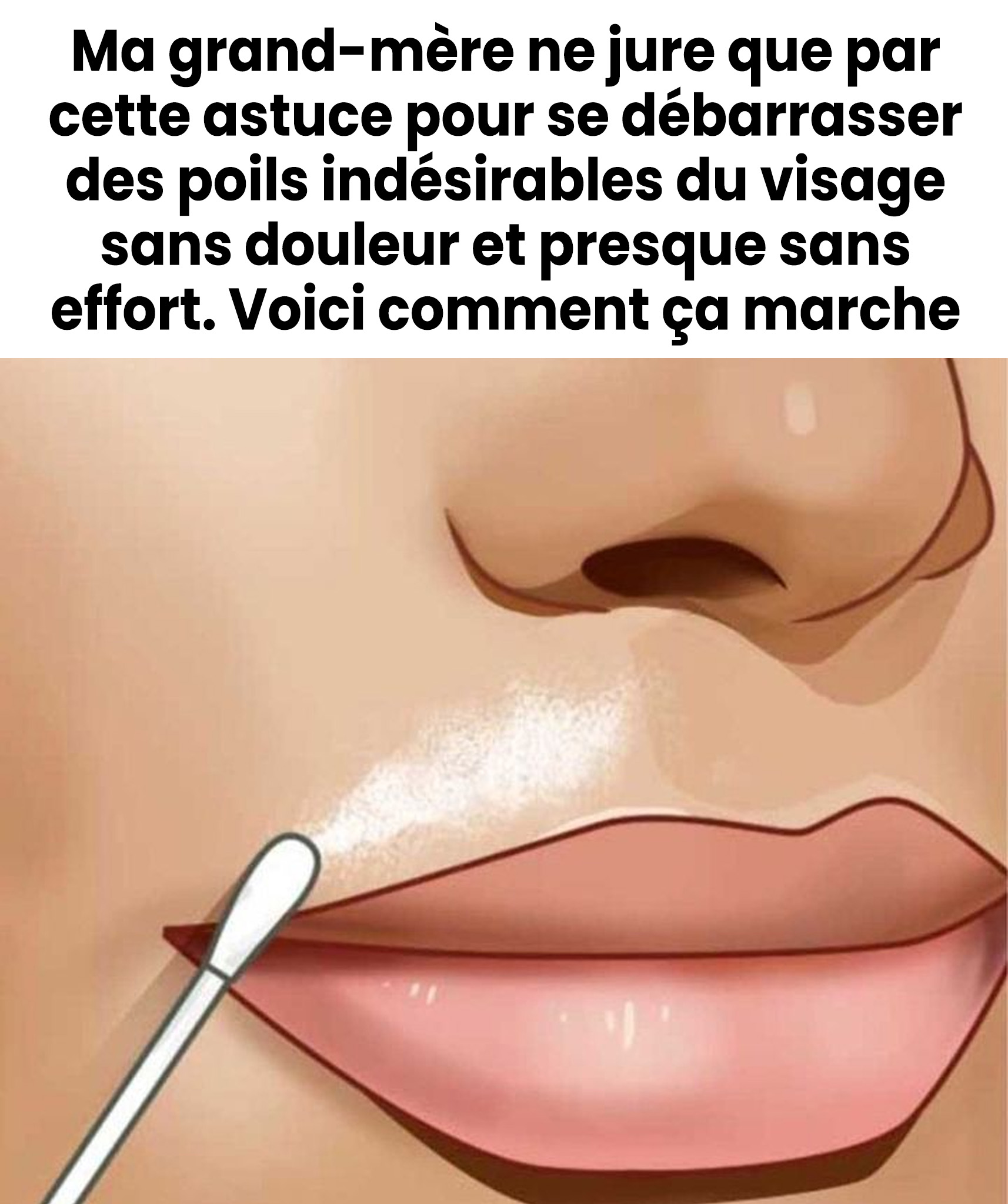 Comment se débarrasser des poils indésirables du visage sans douleur ?