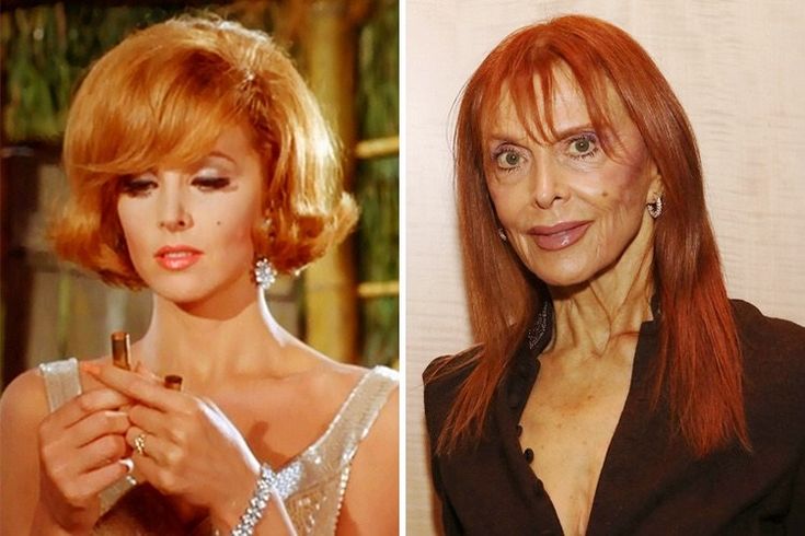 De Brigitte Bardot à Mickey Rourke : quand le temps transforme les visages des icônes