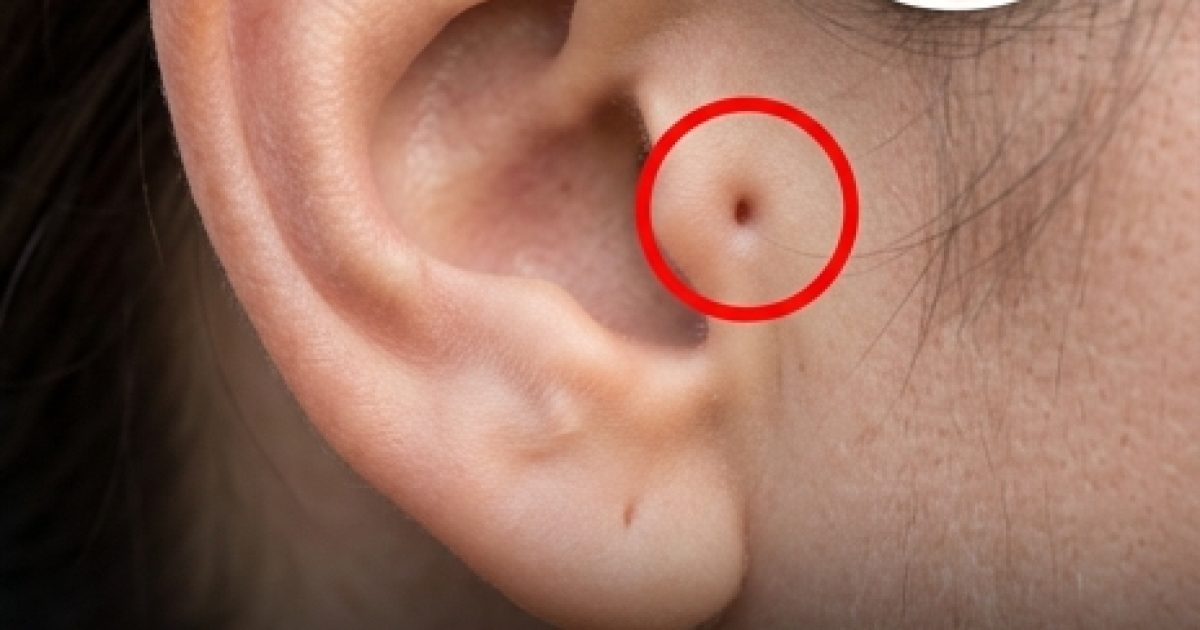 Découvrez la signification de cette marque particulière sur l'oreille