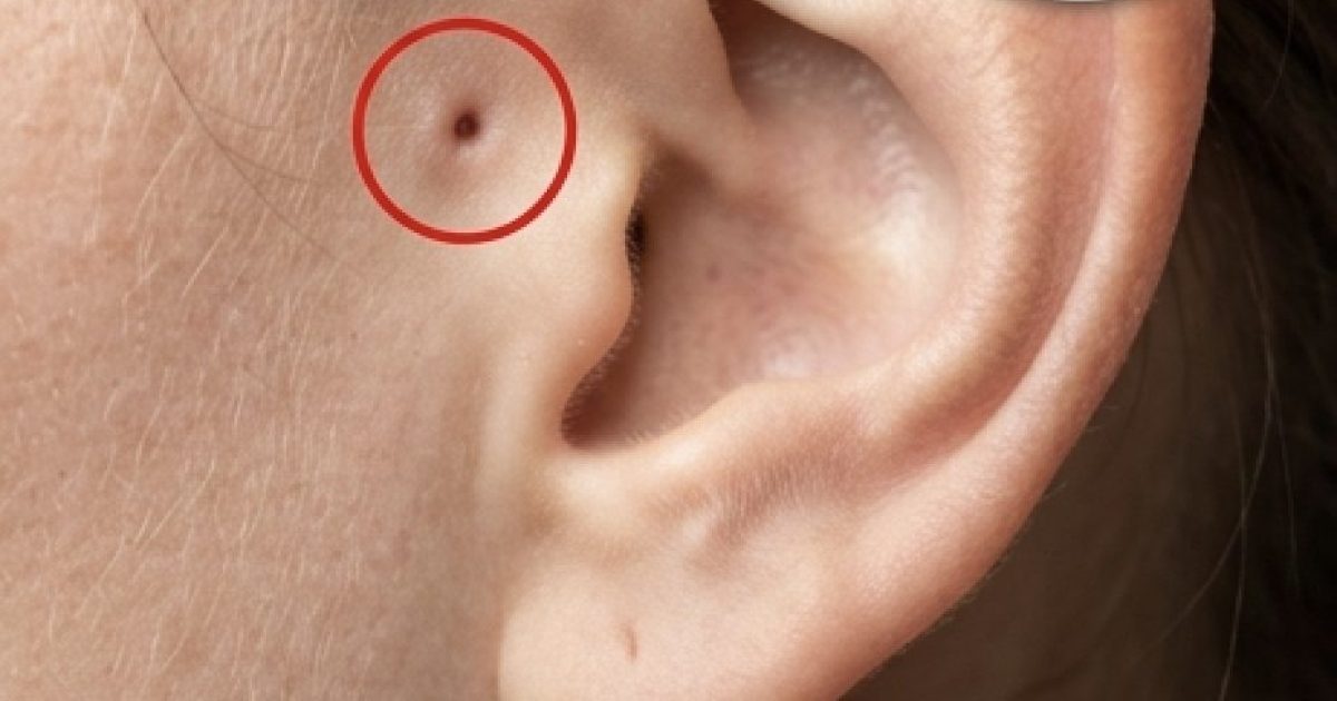 Découvrez la signification de cette marque sur l'oreille