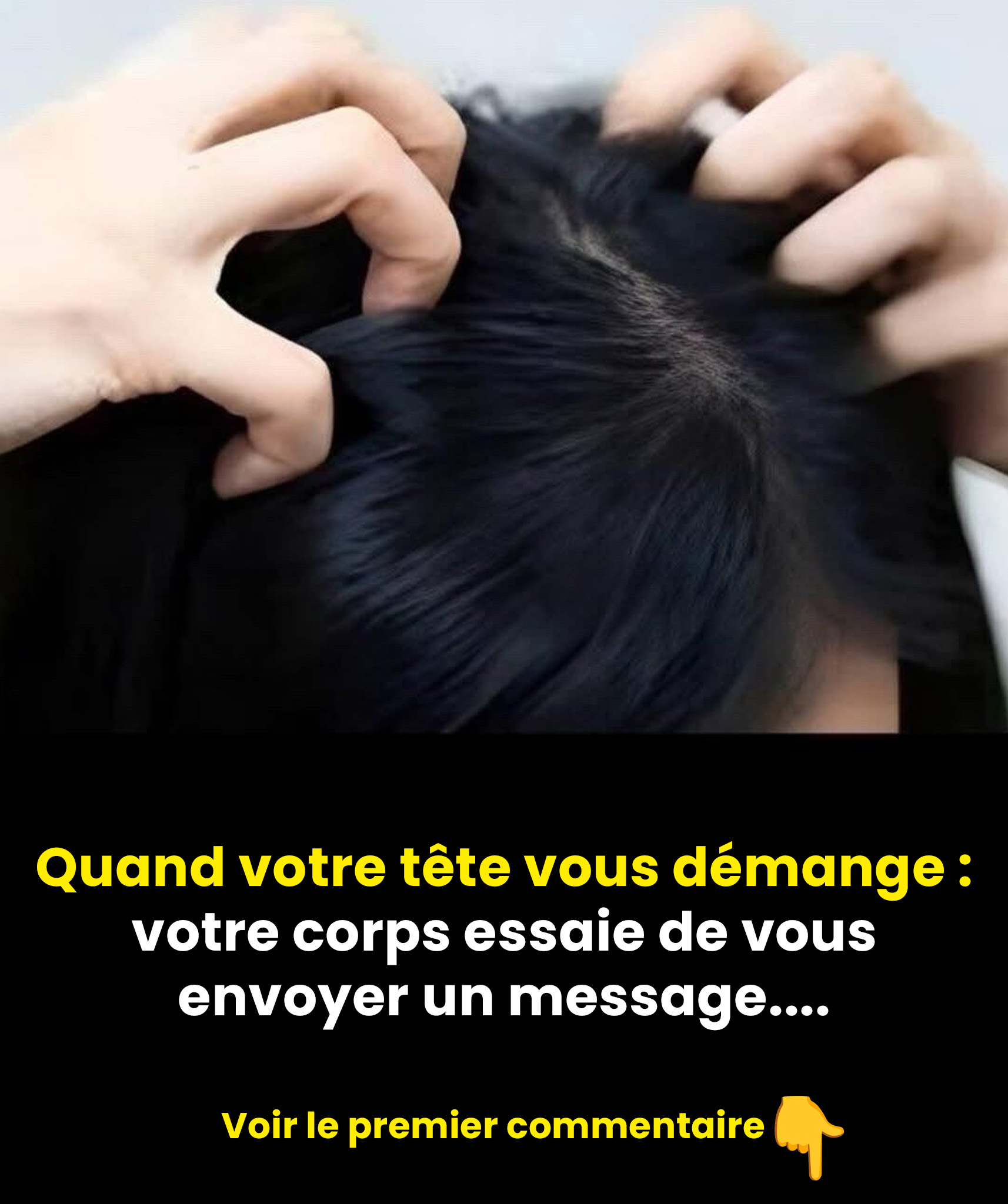 Démangeaisons du cuir chevelu ? Voici les causes les plus courantes