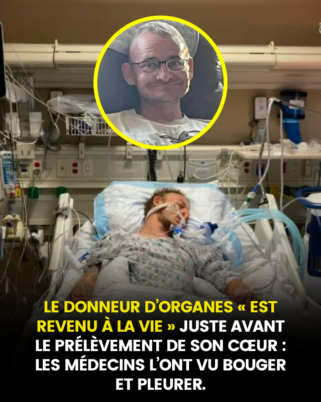 « Des larmes coulaient » : déclaré en état de mort cérébrale, un homme se réveille alors qu’on s’apprêtait à lui prélever ses organes