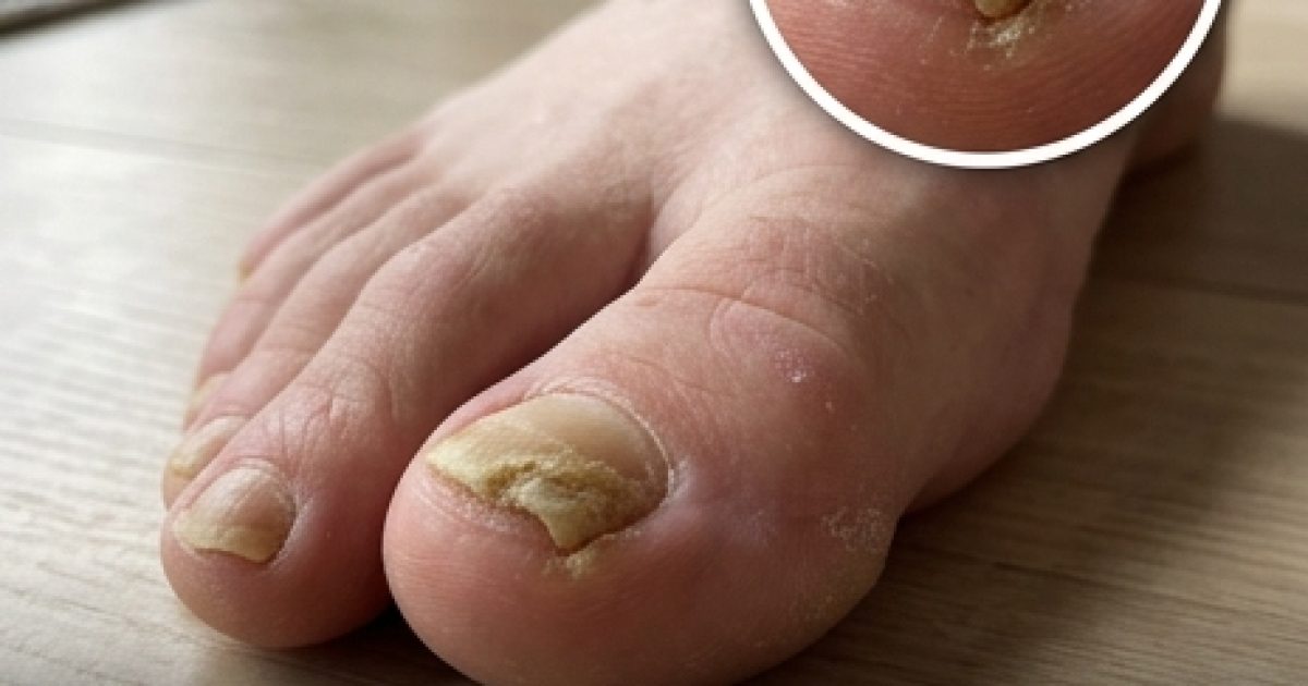 Deux maladies silencieuses que vos pieds peuvent révéler : les signes à repérer et quand consulter