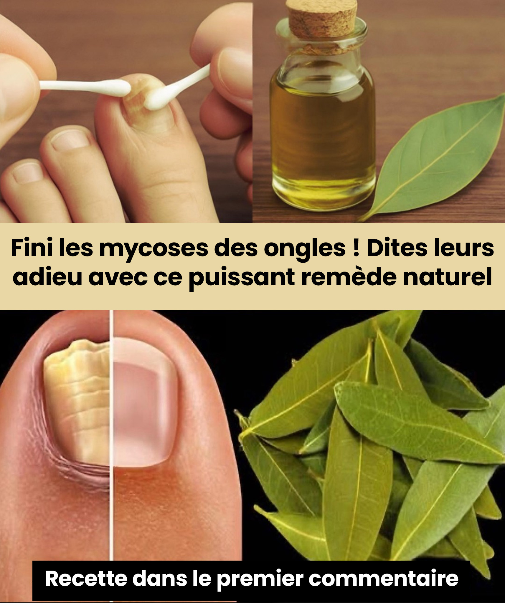 Dites adieu aux mycoses grâce à ce remède naturel