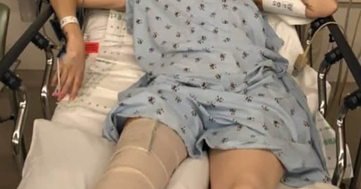 Elle perd ses jambes à cause d’un produit que tout le monde utilise chez soi…