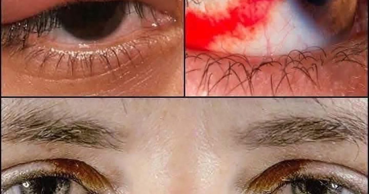 Et si vos yeux essayaient de vous dire quelque chose ?