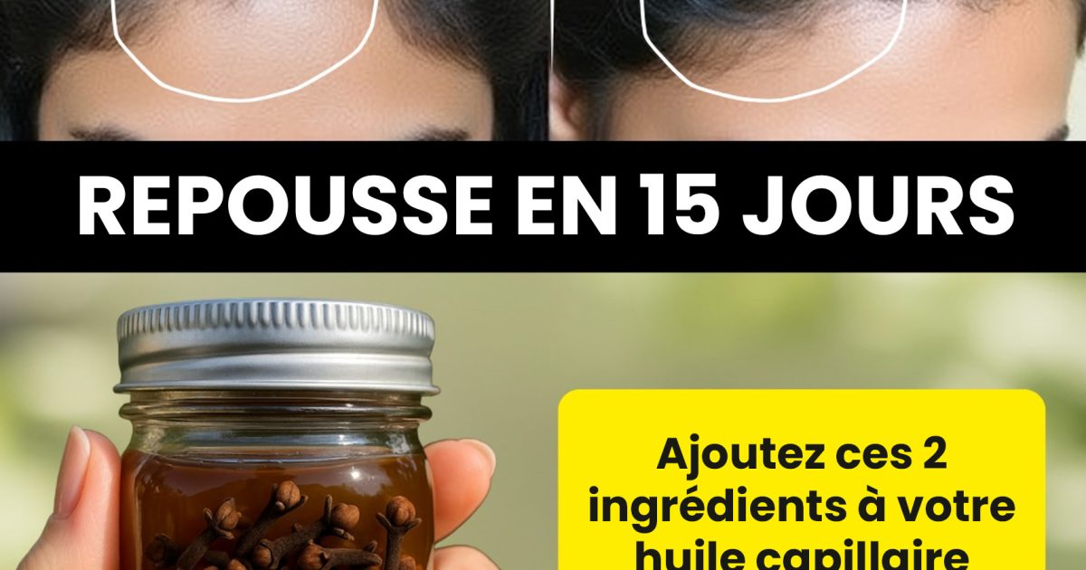 Gel anti-DHT pour stimuler une croissance capillaire plus dense et plus épaisse