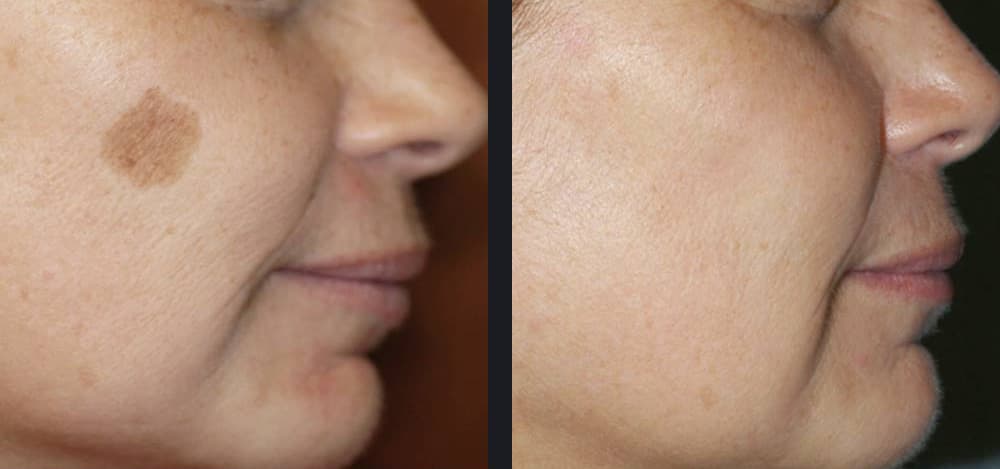L’ingrédient de cuisine qui pourrait révolutionner votre routine visage : secrets d’une peau rajeunie