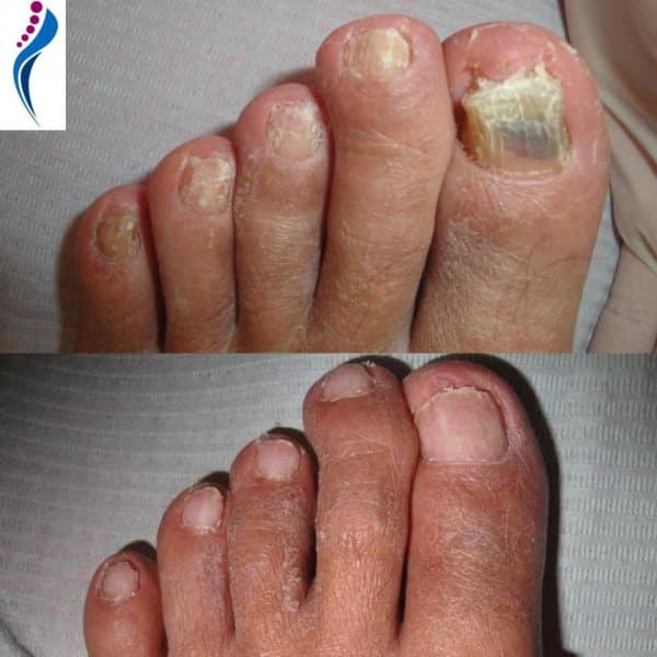 L’astuce oubliée des aînés pour affiner naturellement les ongles des orteils