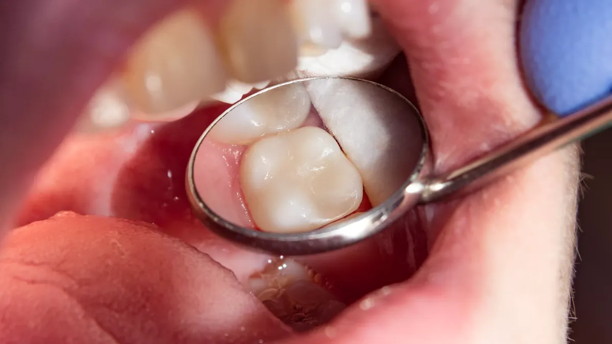 Dentiste : le drame silencieux d’une fillette de 9 ans décédée après des soins courants