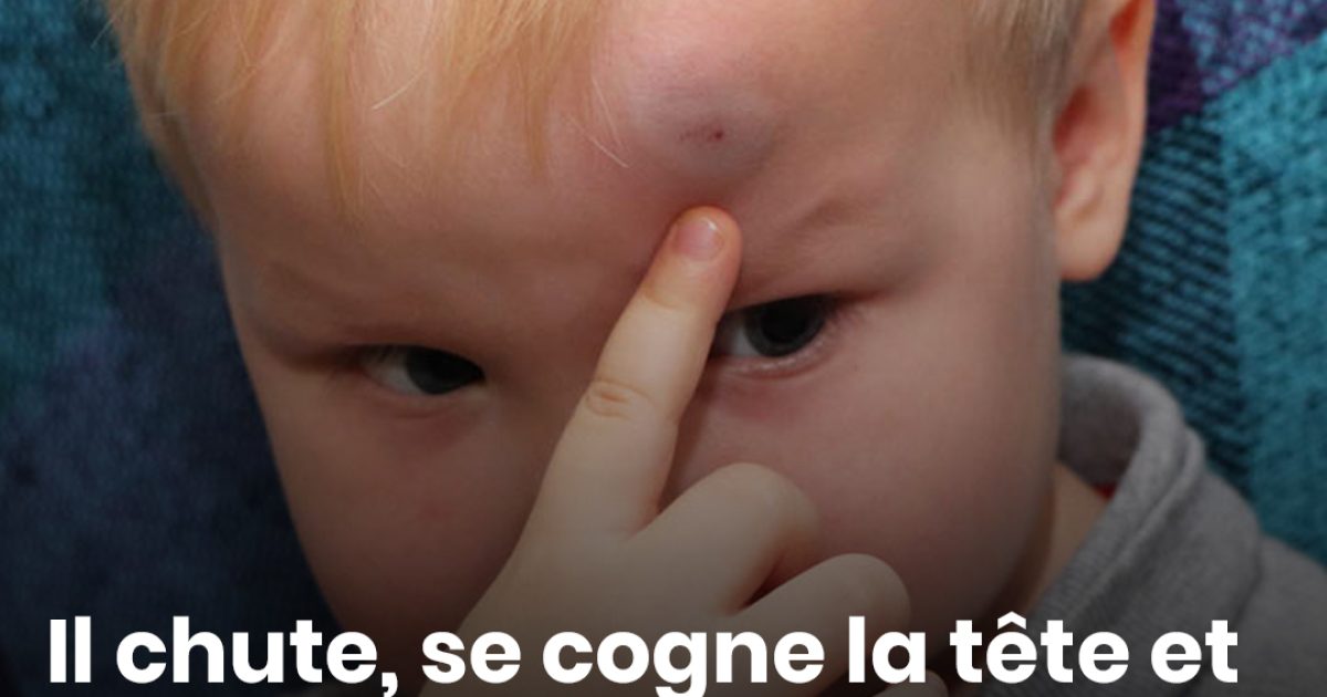 Il chute, se cogne la tête et décède quelques heures plus tard : les 11 signes d'alerte à surveiller chez un enfant, selon un médecin