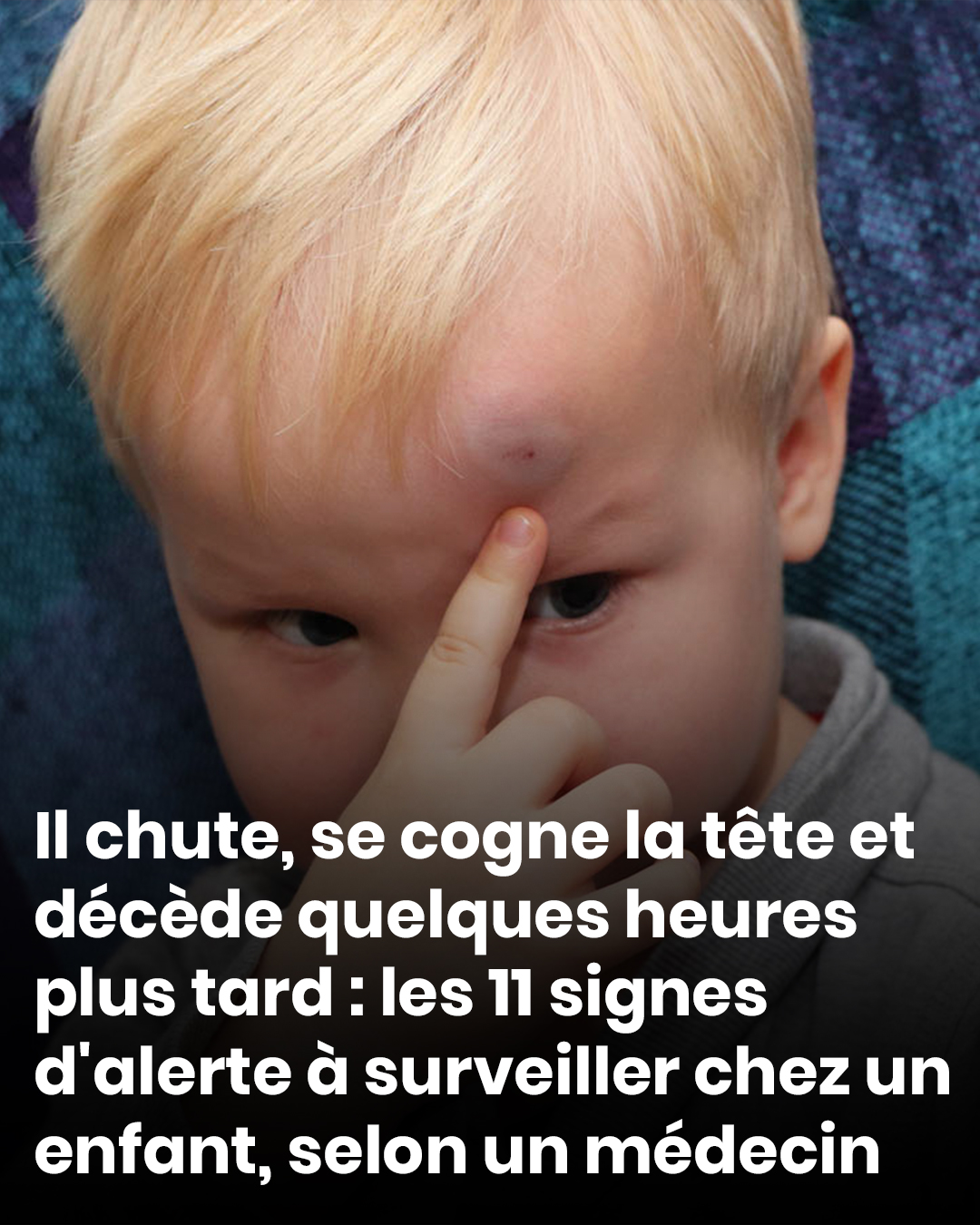 Il chute, se cogne la tête et décède quelques heures plus tard : les 11 signes d'alerte à surveiller chez un enfant, selon un médecin