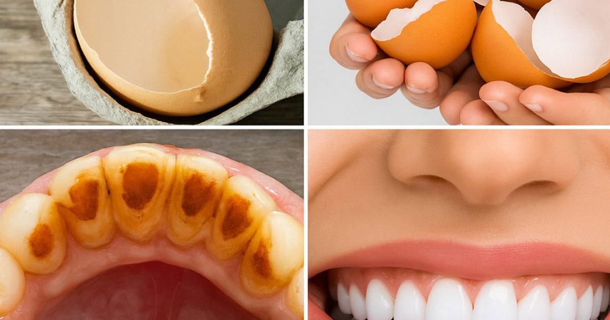 Illuminez votre sourire grâce à des ingrédients simples