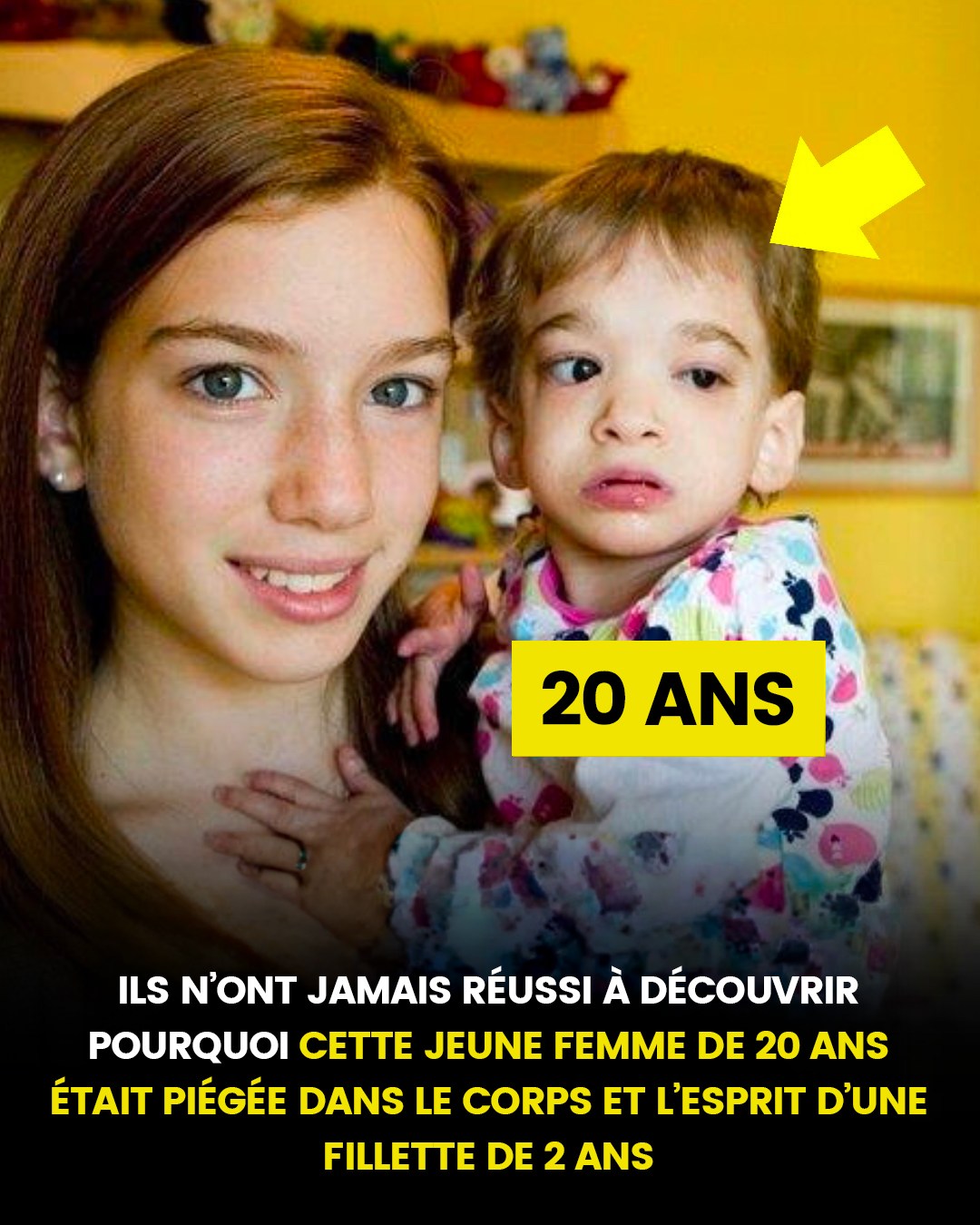 Ils n’ont jamais réussi à découvrir pourquoi cette jeune femme de 20 ans était piégée dans le corps et l’esprit d’une fillette de 2 ans