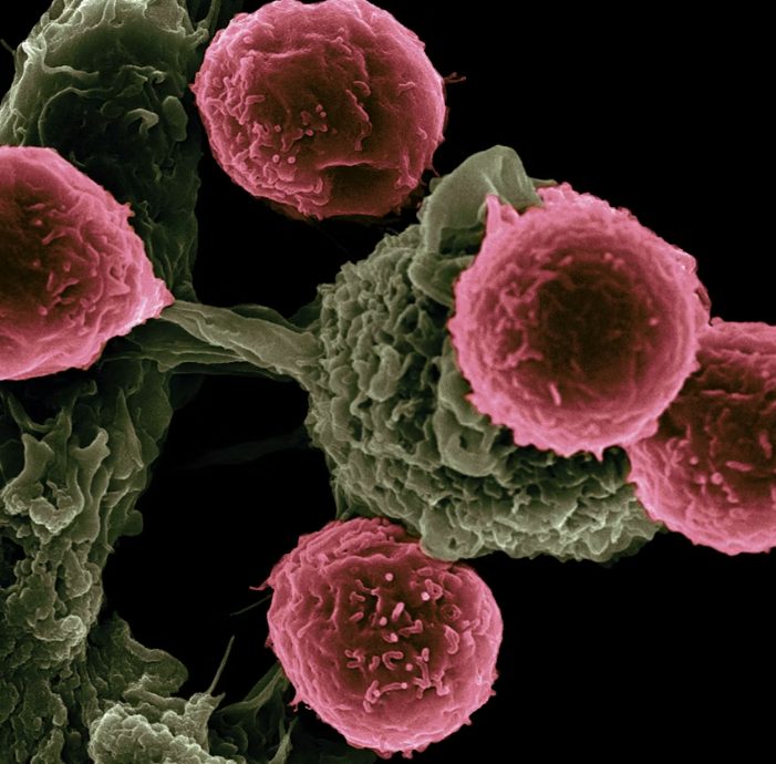 Vous avez franchi le cap des 60 ans sans ces 5 soucis de santé ? Voici pourquoi vous pourriez bien souffler vos 100 bougies.