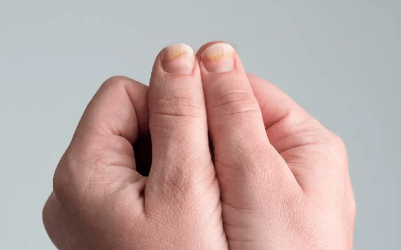 Votre santé se lit au bout des doigts : 8 indices que vos ongles vous dévoilent (et comment y remédier)