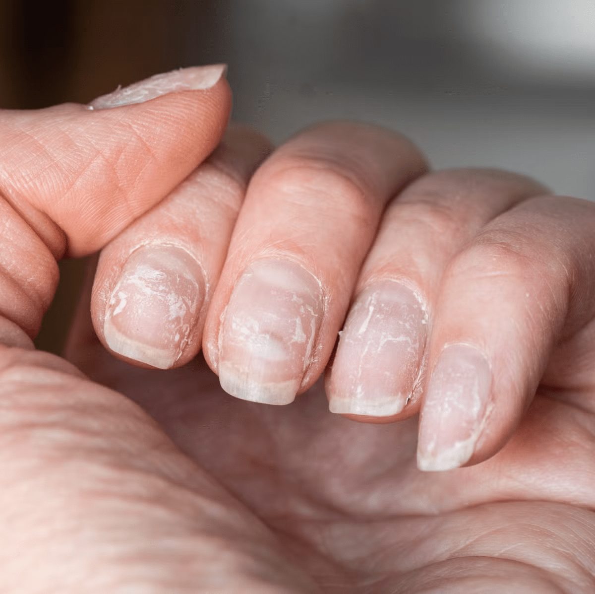 Votre santé se lit au bout des doigts : 8 indices que vos ongles vous dévoilent (et comment y remédier)