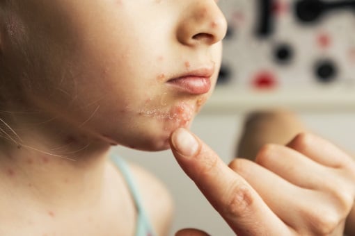 Petits points rouges sur la peau : ce que votre corps essaie vraiment de vous dire