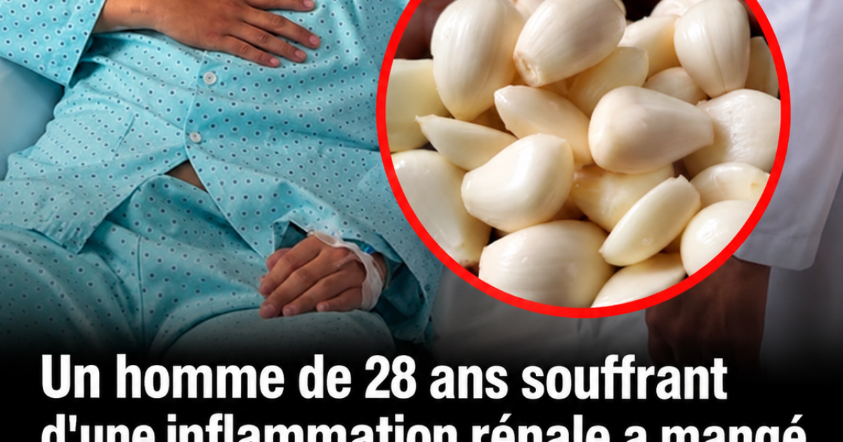 Il a mangé de l'ail tous les jours pendant 5 mois : ce que les médecins ont observé sur ses reins