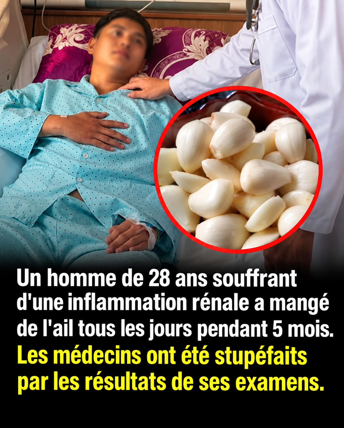 Il a mangé de l'ail tous les jours pendant 5 mois : ce que les médecins ont observé sur ses reins