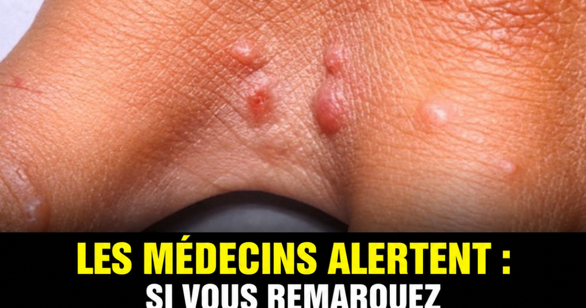 Ces petits points rouges sur la peau qui grattent : le signal d'alerte que personne ne devrait ignorer